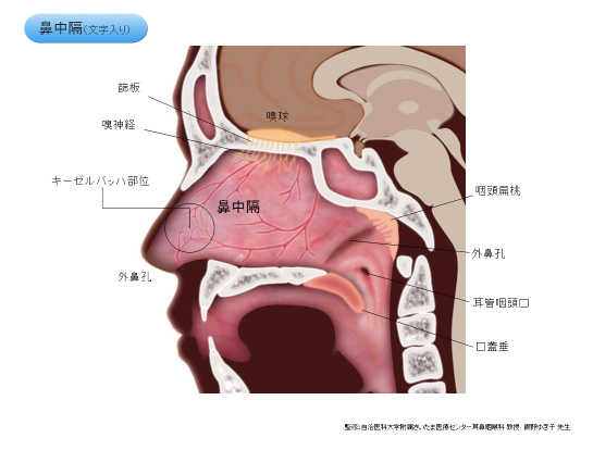 鼻出血症